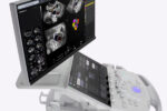 Voluson Performance 18 - Image 2