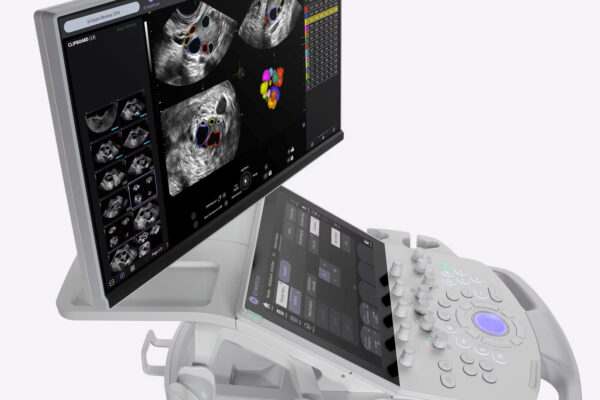 Voluson Performance 18 - Image 3