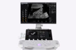 Voluson Performance 18 - Image 4