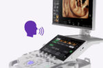 Voluson Performance 18 - Image 5